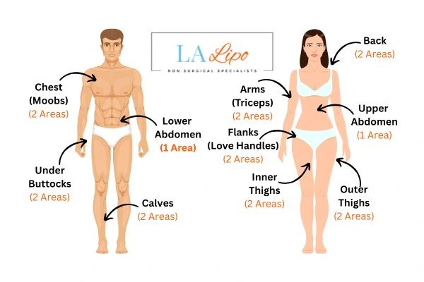 LA LIPO Cryolipolysis Areas Buckinghamshire