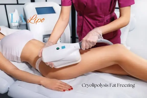 Woman receiving coolsculpting Buckinghamshire treatment on her thighs
