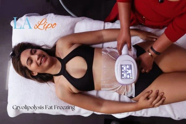 woman getting cryolipolysis Buckinghamshire