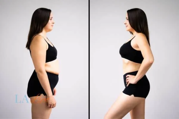 link between body image and mental health Buckinghamshire