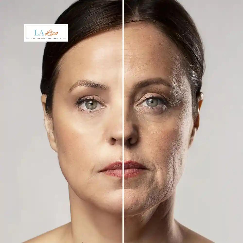 How Can You Tell If Non-Surgical Skin Tightening Is Right for You Buckinghamshire?