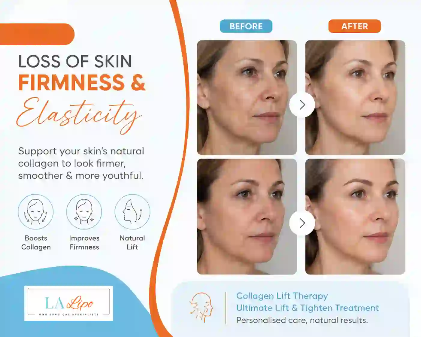 Sign #7: Loss of Skin Firmness and Elasticity Buckinghamshire